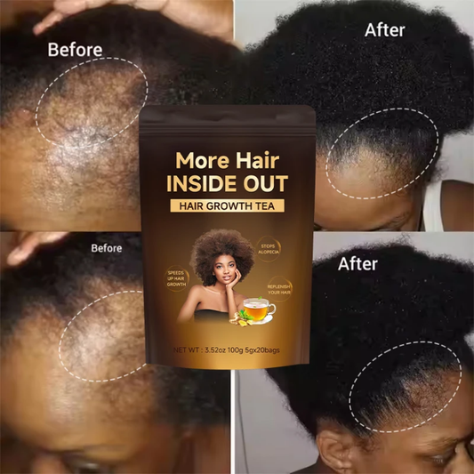 Thé Naturel pour la Pousse des Cheveux – Force & Brillance